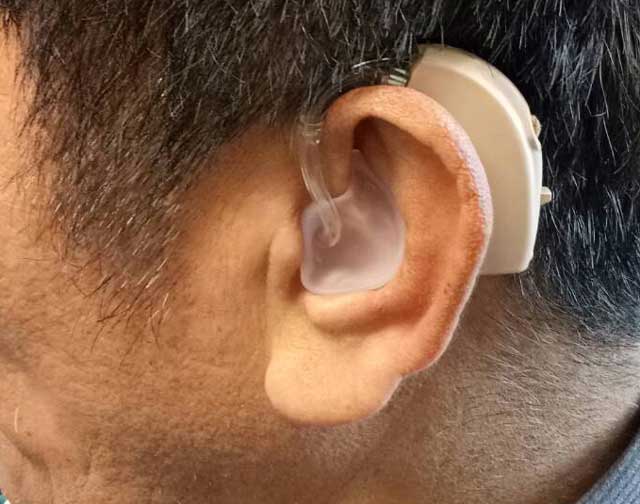 เครื่องช่วยฟัง