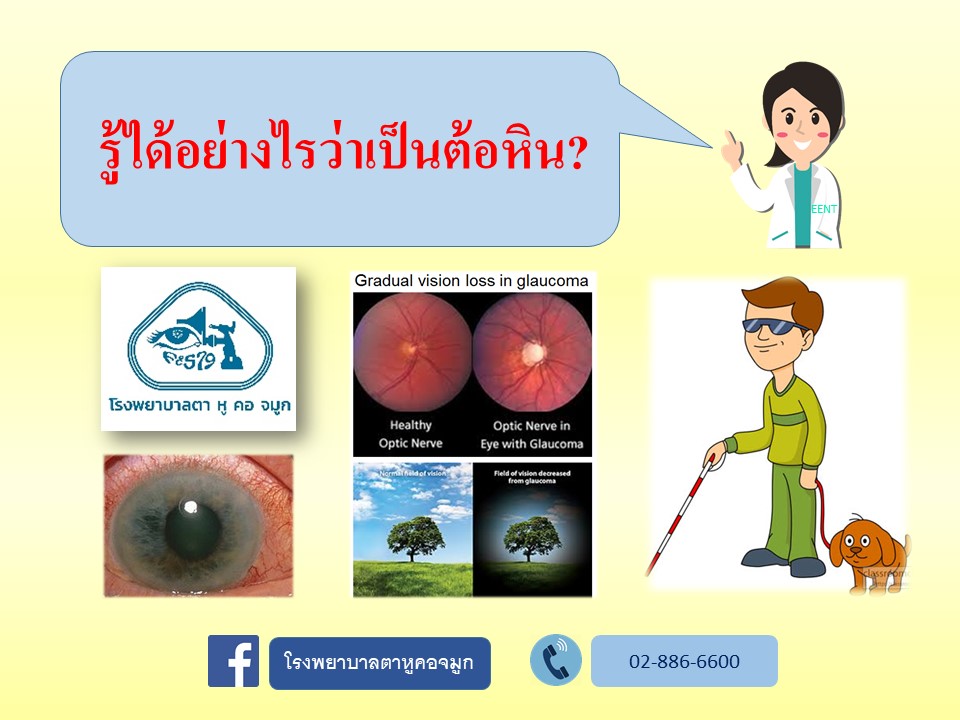 ตายังเห็นดี ไม่เห็นมีอาการอะไรเลย ทำไมต้องมาตรวจหาต้อหินด้วย?
