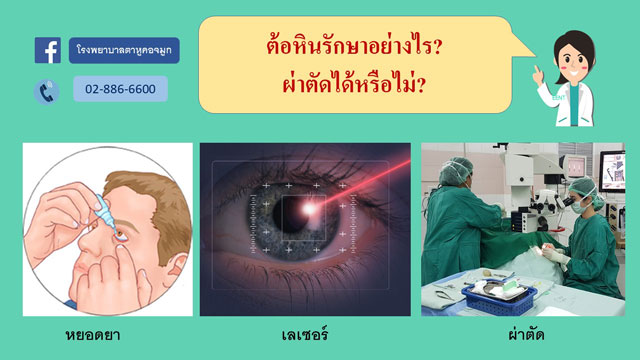 ต้อหิน