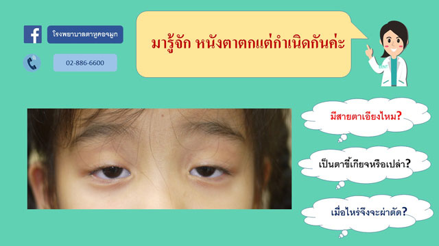 โรคหนังตาตกแต่เกิด