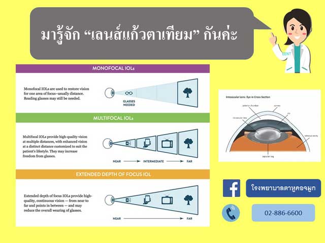 เลนส์แก้วตาเทียม