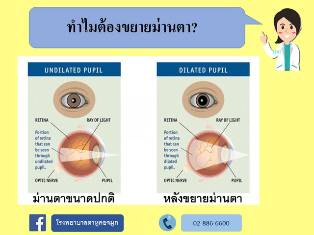 ทำไมต้องขยายม่านตา