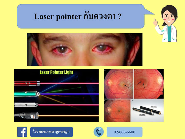 laser