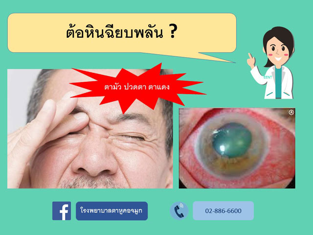 ต้อหินเฉียบพลัน