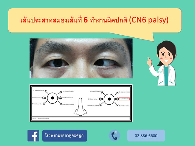 เส้นประสาทสมองเส้นที่