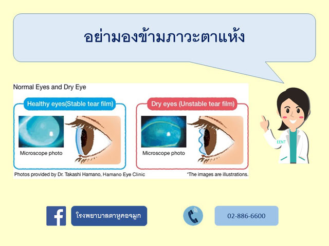 อย่ามองข้ามภาวะตาแห้ง