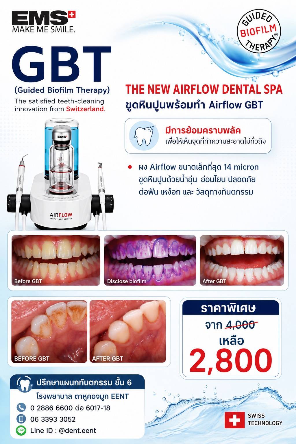Promotion4 Airflow Dental Spa