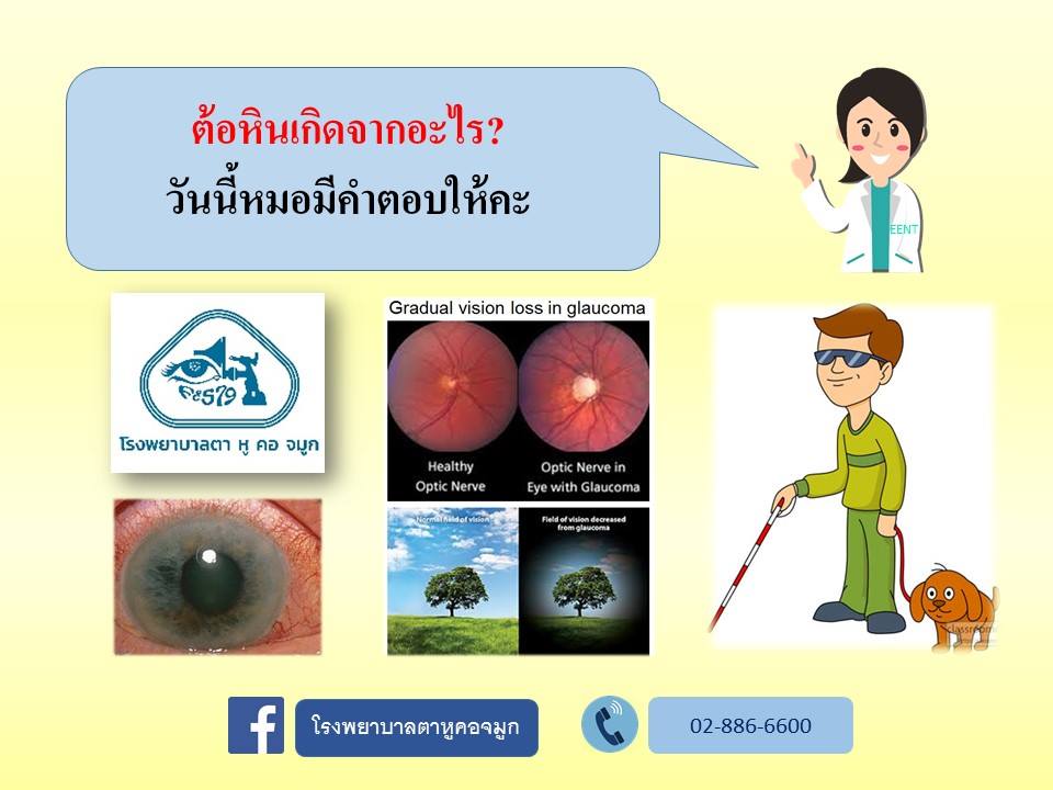 ต้อหินเกิดจากอะไรใครรู้บ้าง?