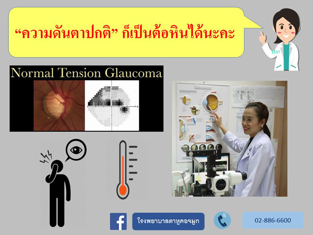 ความดันตาปกติก็เป็นต้อหินได้