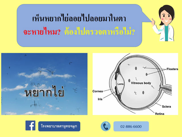 น้ำวุ้นตาเสื่อม