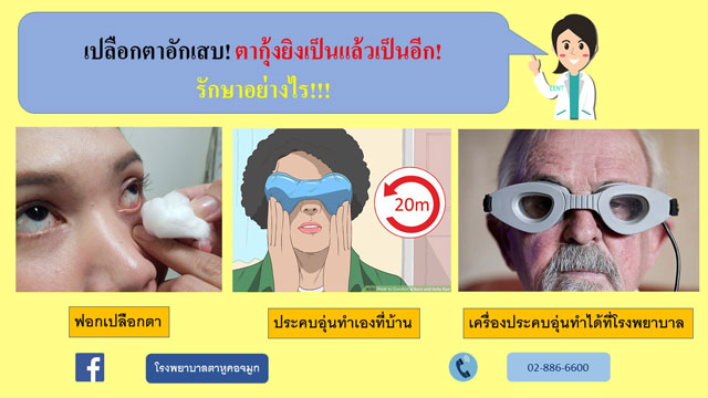 สุขอนามัยบริเวณเปลือกตา