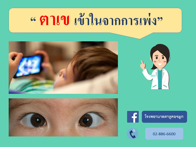 ตาเขเข้าในการจากการเพ่ง