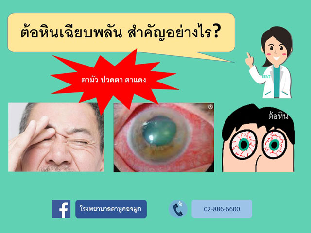 ต้อหินเฉียบพลัน