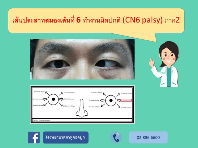 เส้นประสาทสมองเส้นที่