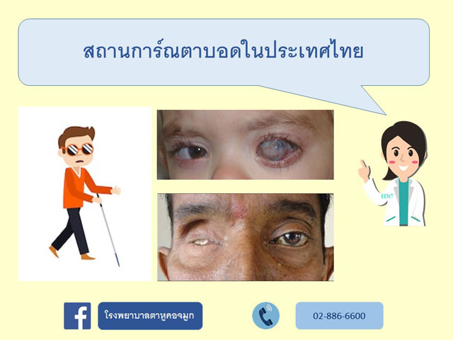 สถานการ์ณตาบอดในประเทศไทย