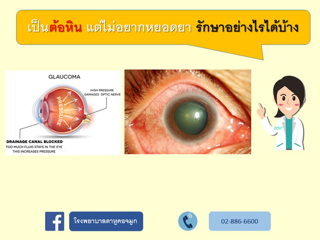 เป็นต้อหินแต่ไม่อยากหยอดยา