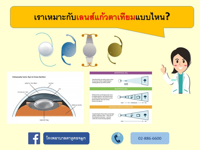 เราเหมาะกับเลนส์แก้วตาเทียมแบบไหน?