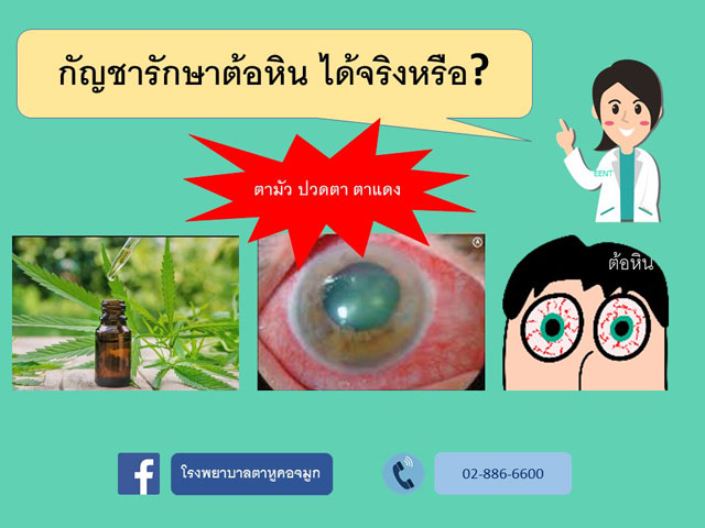 กัญชารักษาต้อหินได้จริงหรือ?