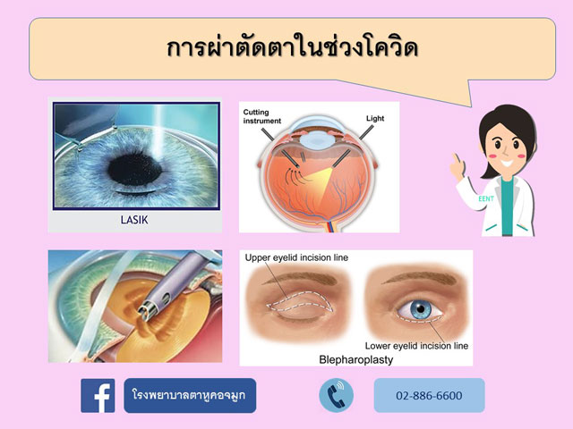 การผ่าตัดตาในยุคโควิด