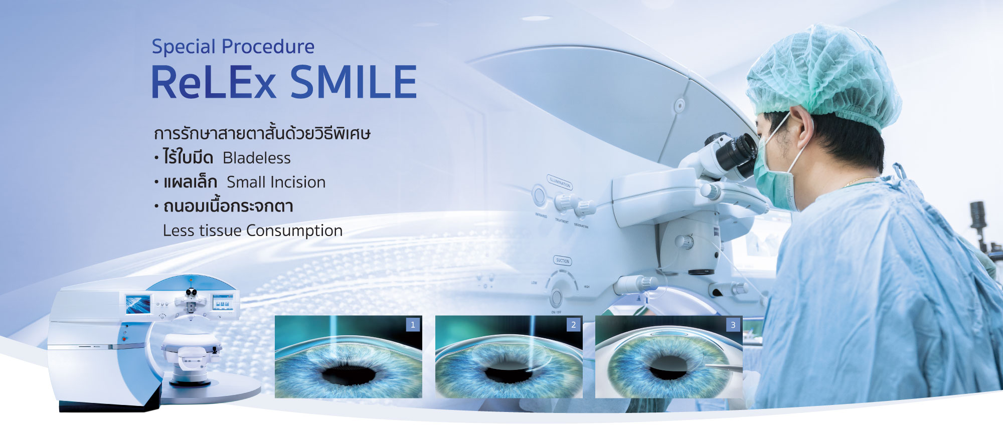 LASIK ReLEx SMILE